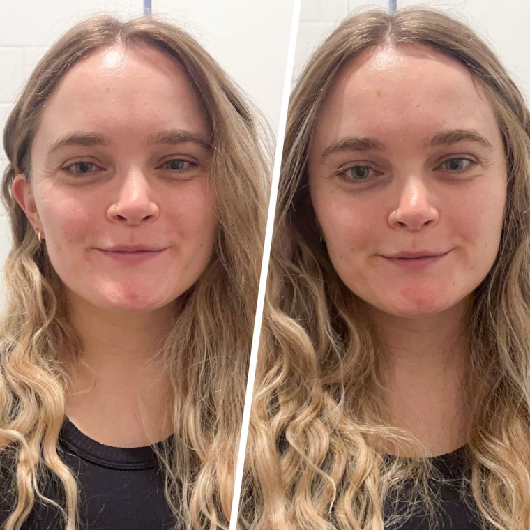 Before and after using the ZIIP Halo.