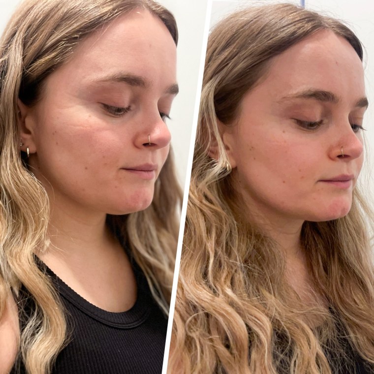 Before and after using the ZIIP Halo.
