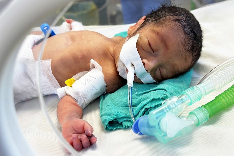 Premature babies struggle for life in Gaza under Israeli attacks