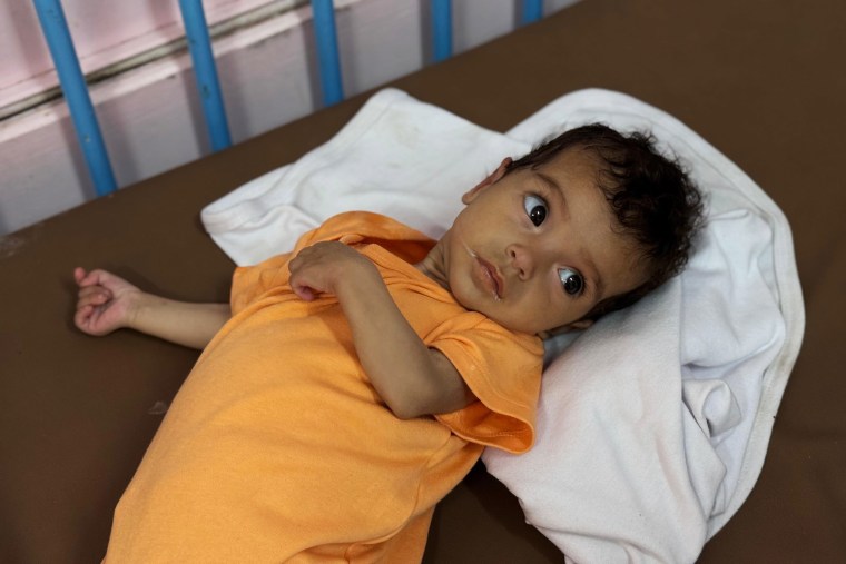 Children starving in Gaza