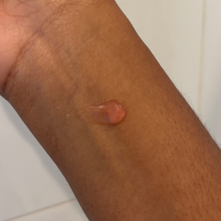 Dot of primer on woman’s arm