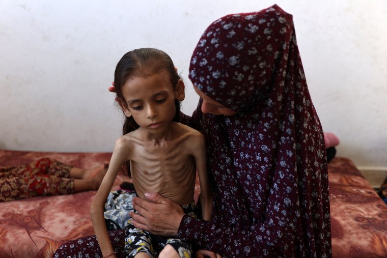 Outcry in Israel as Hamas releases video of emaciated hostage alongside starving Palestinian children Image: PALESTINIAN-ISRAEL-CONFLICT