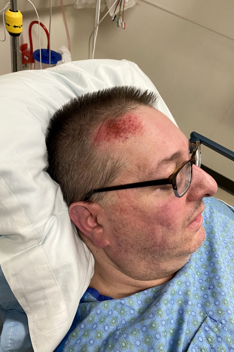 John Karadell with a large abrasion on his head.