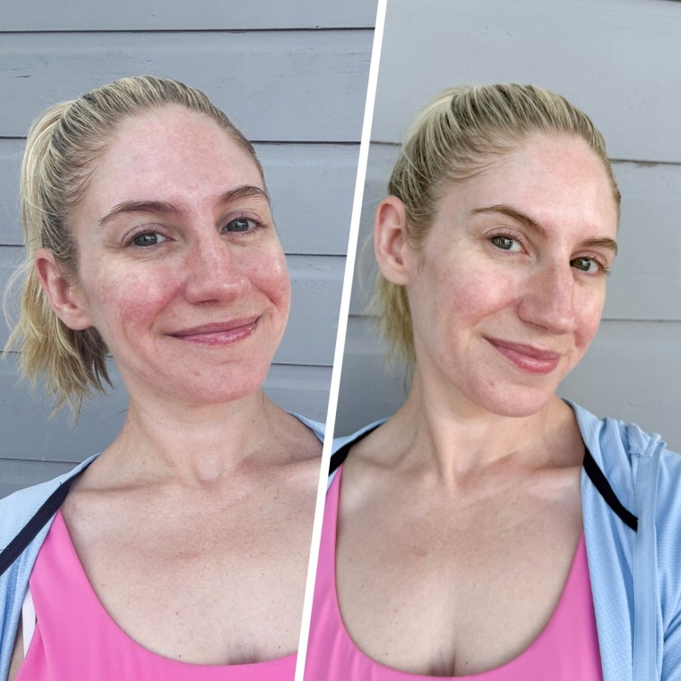 Before and after using the Medicube Salmon PDRN Pink Collagen Jelly Gel Mask.