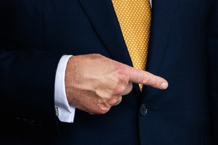 Trump's makeup covered hand