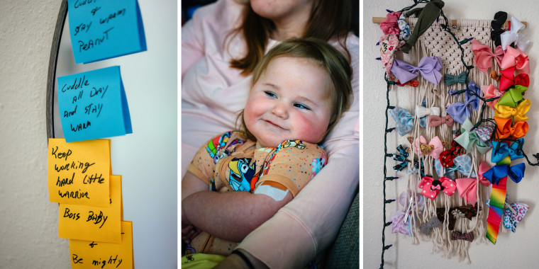 Aicardi syndrome, diagnosed in a few thousand people worldwide, almost always occurs in girls.
