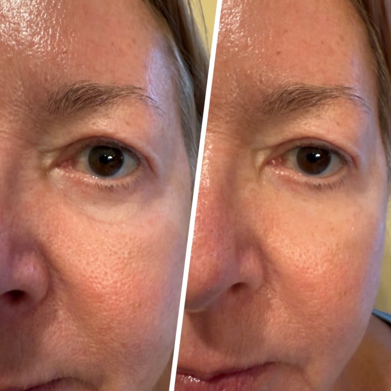 The mother of commerce editor and producer, Julie Ricevuto, testing out the Peter Thomas Roth eye tightener.