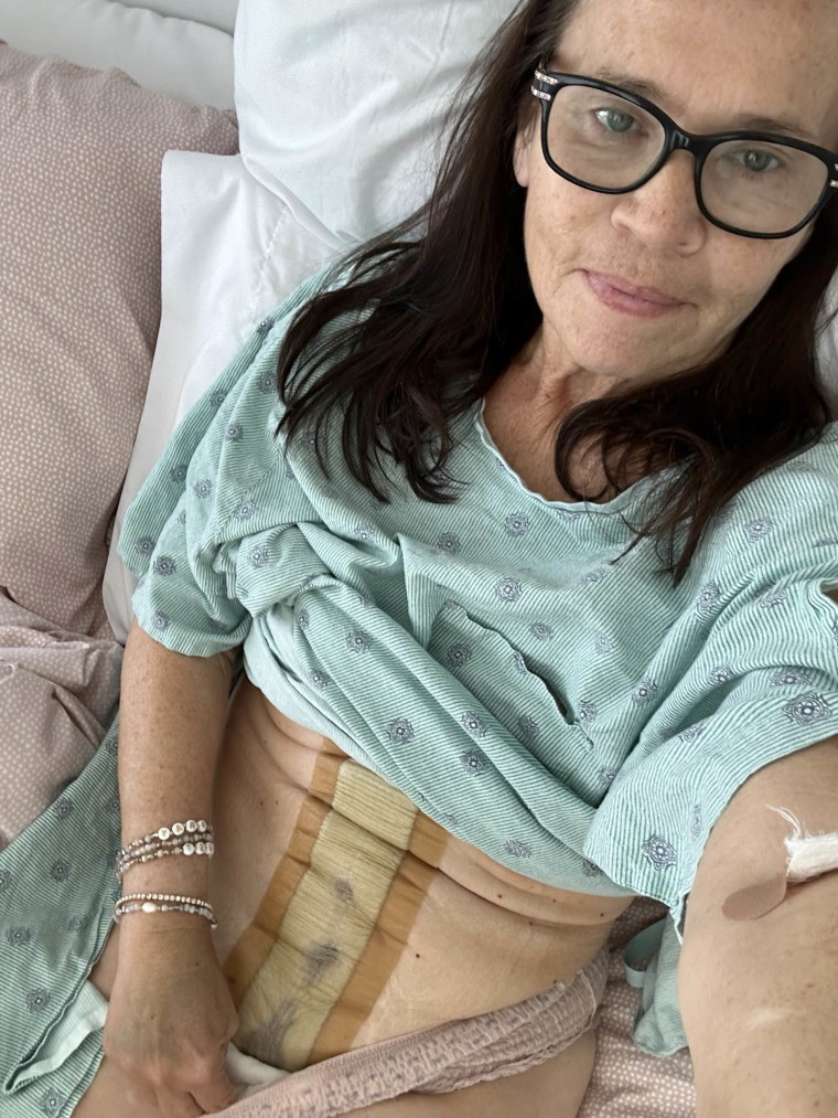 Woman Reveals 2 Ovarian Cancer Symptoms She Dismissed