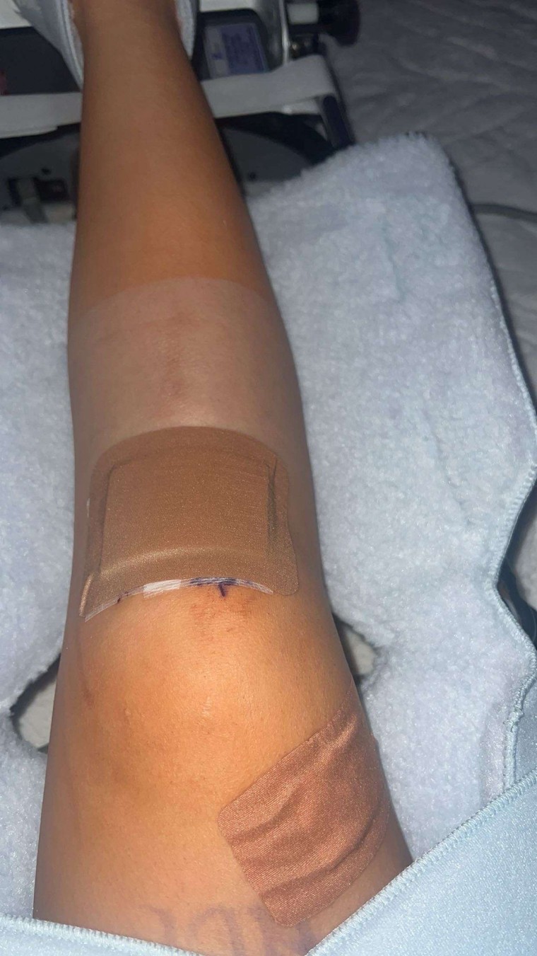 Natalie Silva masih dalam masa pemulihan dari cedera ligamen anterior di lutut kanannya yang menurutnya terjadi pada Februari 2024 saat pertandingan sepak bola sekolah menengah yang dimainkan di lapangan rumput.