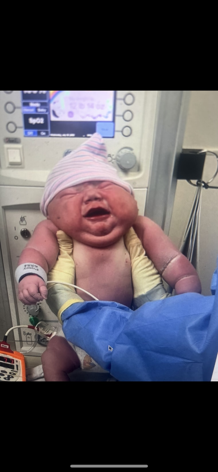 Tennessee Mom Shelby Martin Gives Birth to Record Setting Big Baby