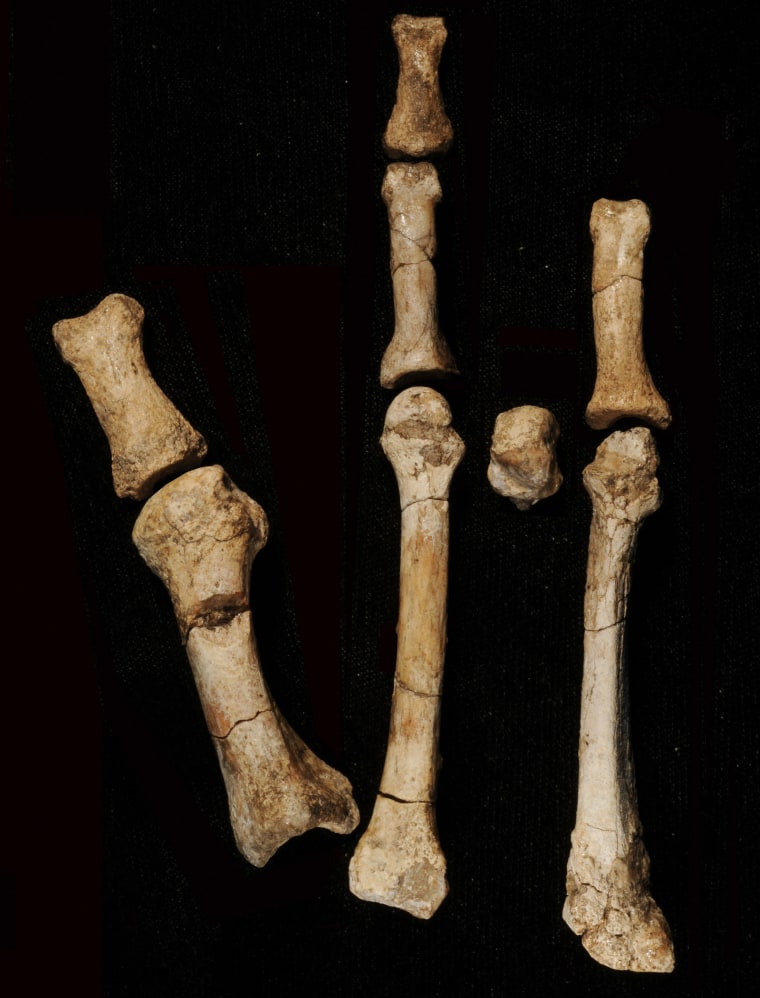 Elements of the Burtele foot.