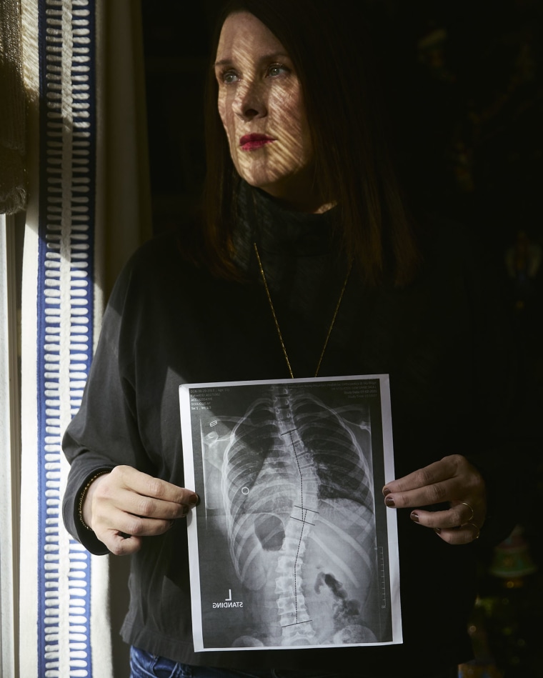 Anne Marie Hukriede holds an X-ray image of her daughter Vivian’s spine at their home in Centennial, Colo., on Nov. 26, 2025. 