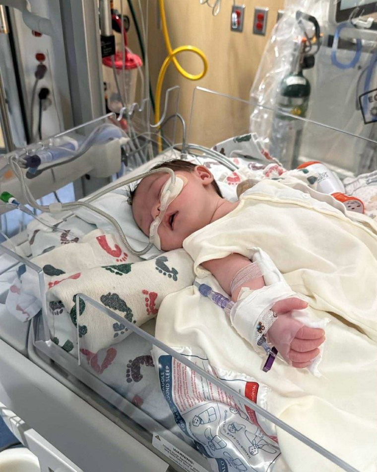 A baby is hooked up to many tubes in a hospital bed