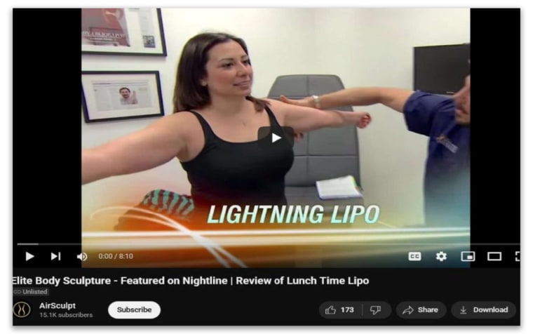 A ação acusa a empresa de propaganda enganosa, alegando que minimiza os riscos do procedimento, o que a empresa nega.