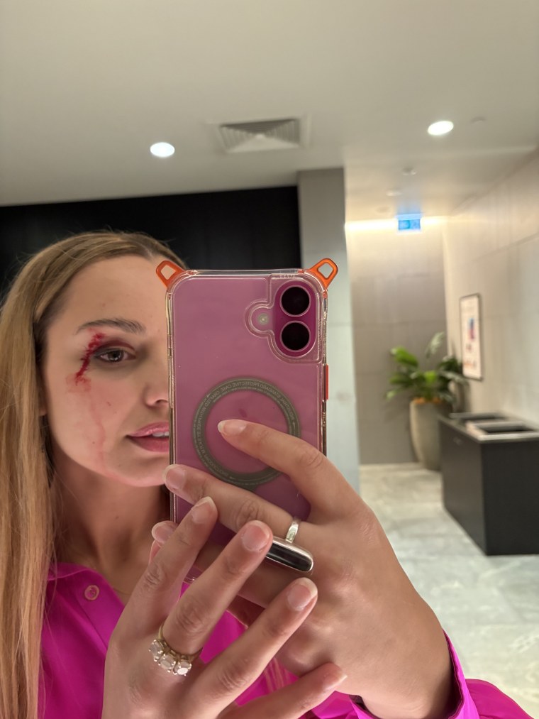 Jess Tyson after the incident.