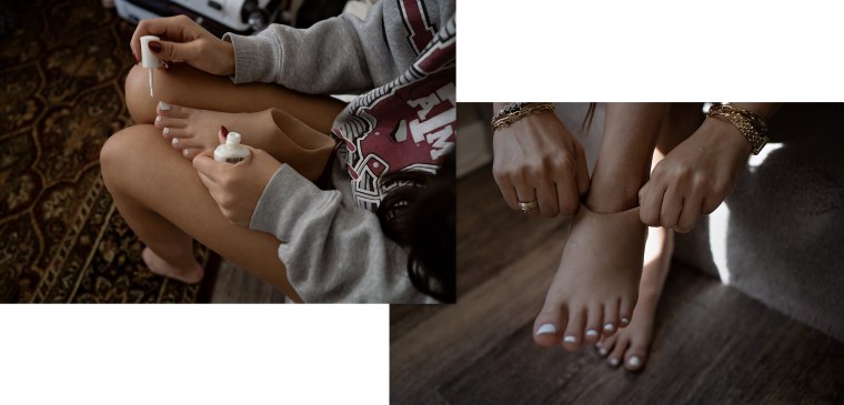 Gabbie Guerrero, 21, paints the toenails of her prosthetic foot 