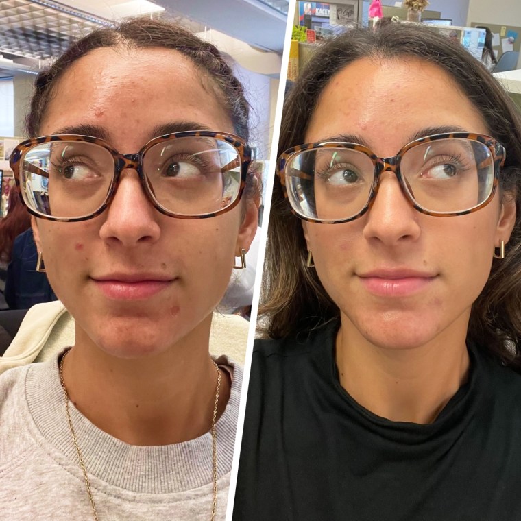 Day 1 vs. 1 week of using Magic Molecule. 