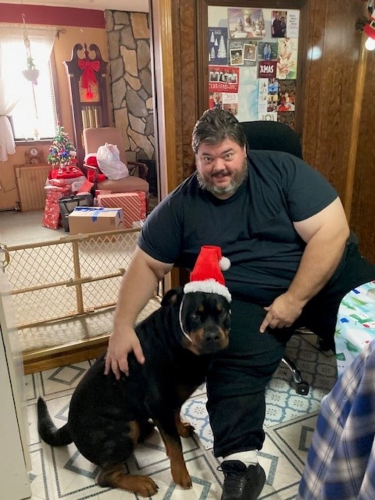 Matthew Castillo developed ulcers on his legs as his weight increased.