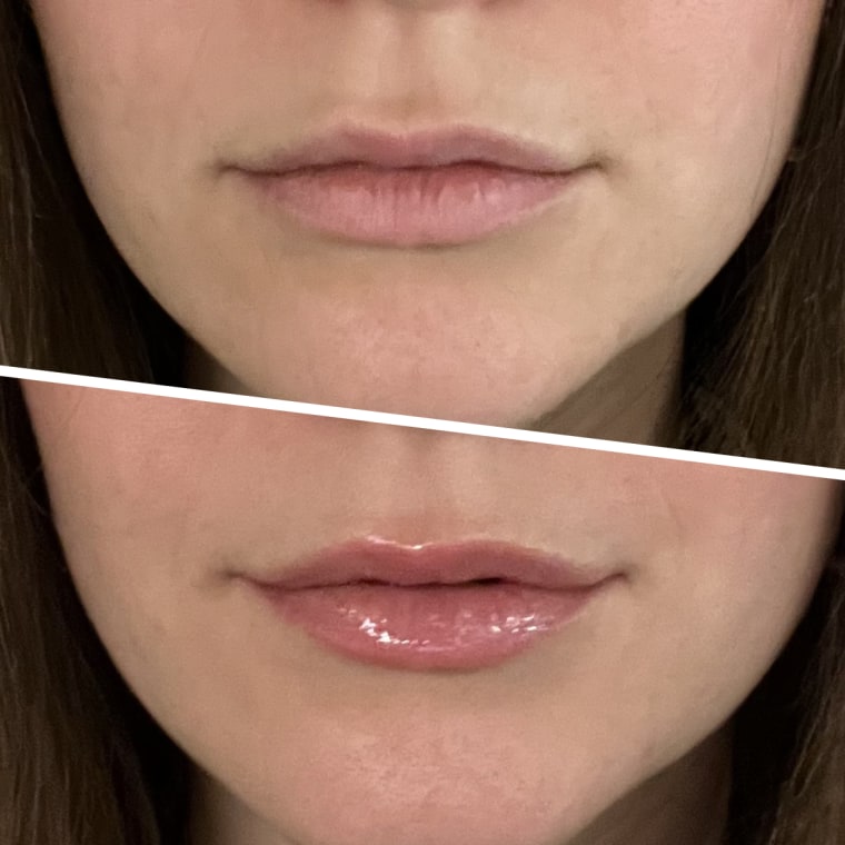Associate producer Isy Tocci before and after wearing the Dr Dennis Gross DermInfusions Plump + Repair Tinted Lip Treatment.