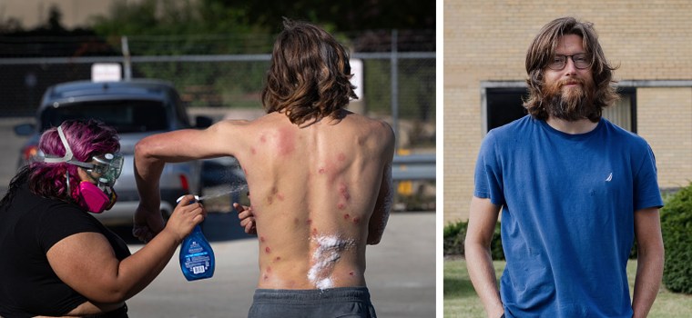 Levi Rolles, who attended multiple protests at ICE's facility in Broadview, Illinois, was pelted with projectiles.
