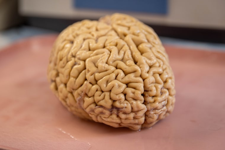 A super-ager brain in the lab.