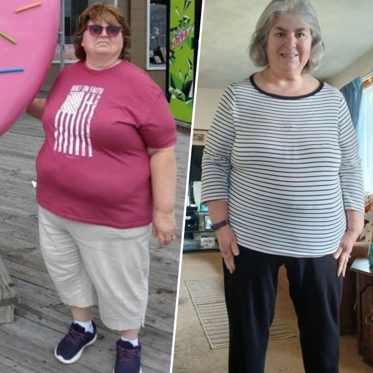 judy wentz start today before and after