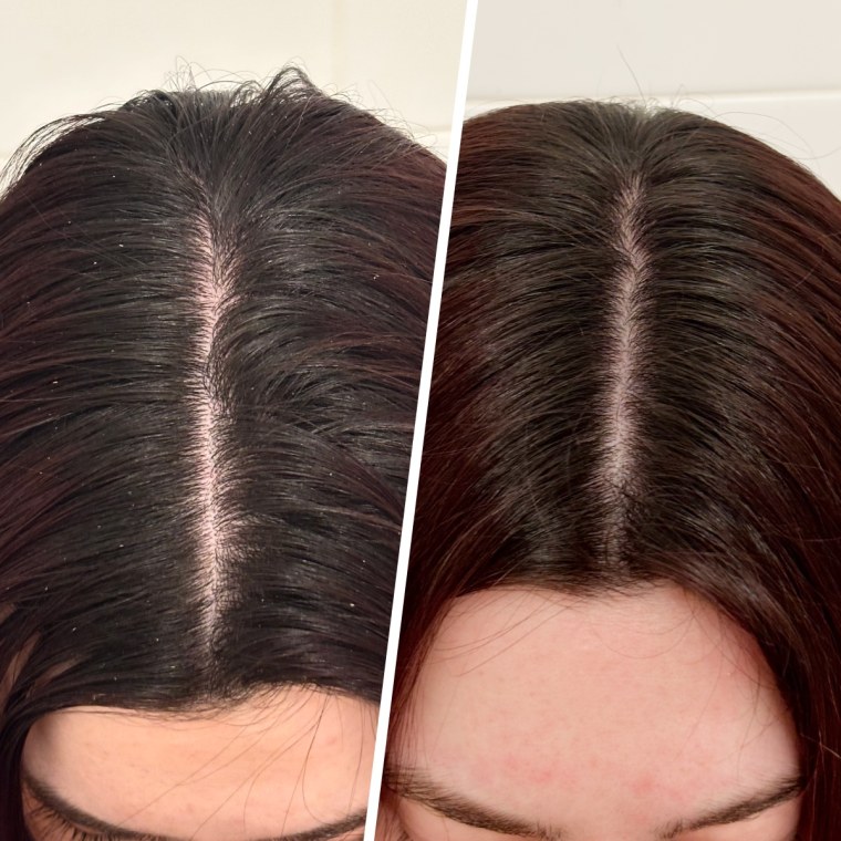 Dr. Groot Scalp Revitalizing Solution Scalp Exfoliating Detox Water before and after use.