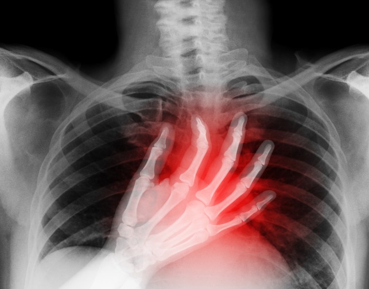 X-ray of hand on heart
