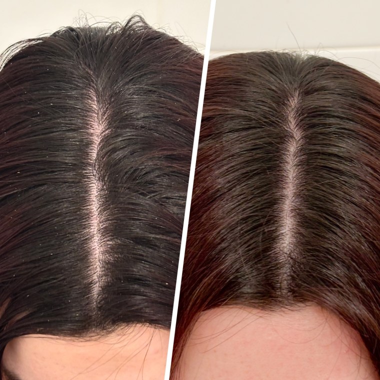 Dr. Groot Scalp Exfoliating Detox Water before and after application