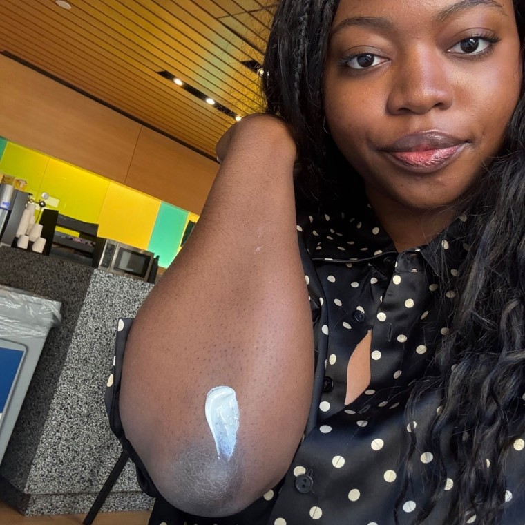 Woman with cream on elbow