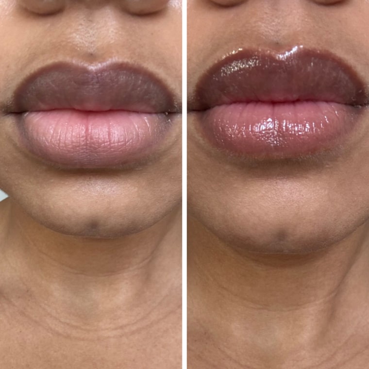 Before and after of woman applying a lip serum