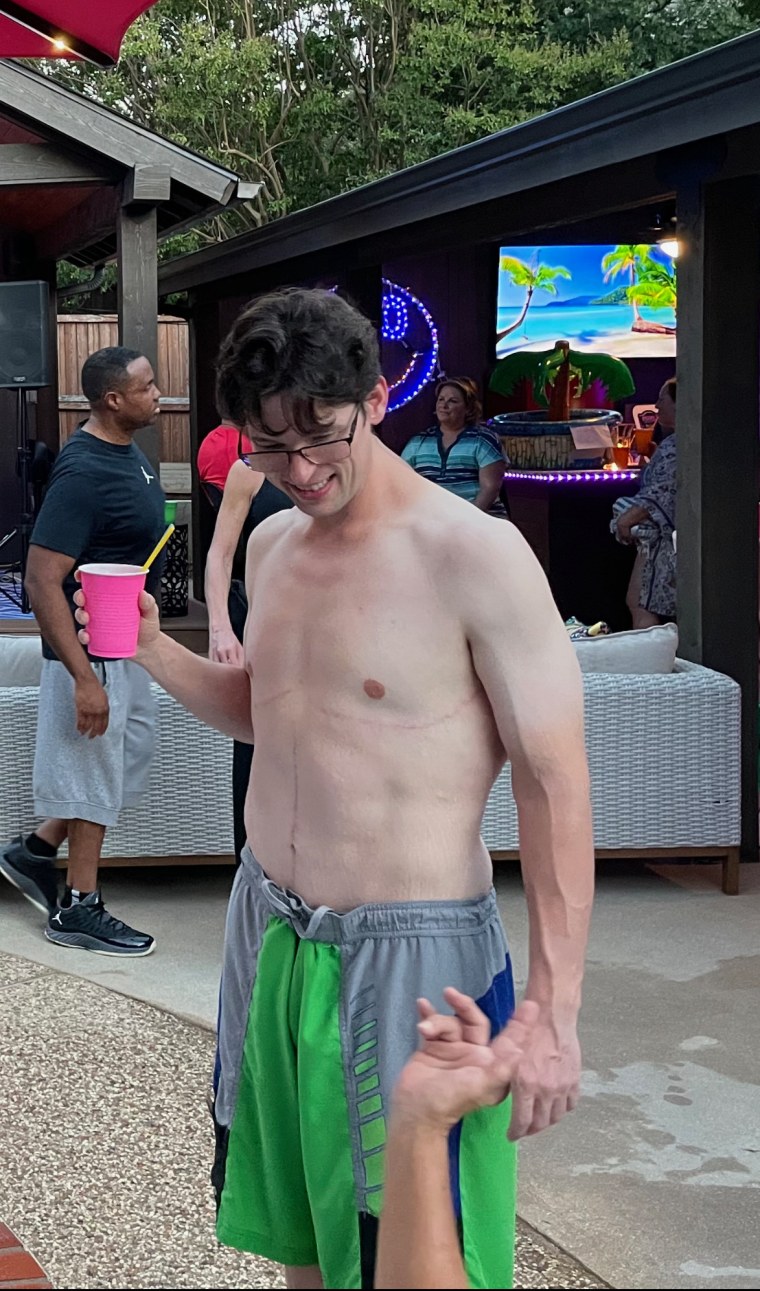 Adam Bird underwent surgery to remove 15 pounds of excess skin following major weight loss.