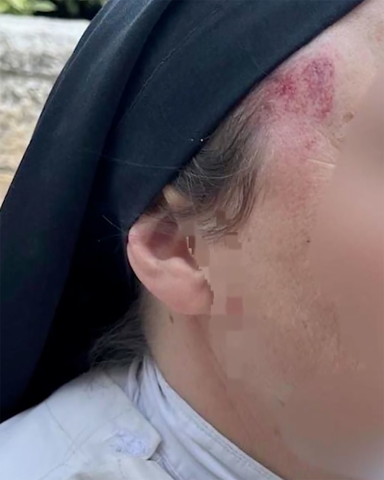 Injuries sustained by the nun were revealed in an image released by Israeli police on Wednesday.