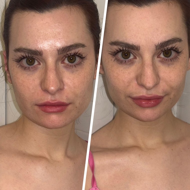 Associate market editor Audrey Ekman before and after applying the One/Size Oil Sucker Spray to combat oil accumulation.