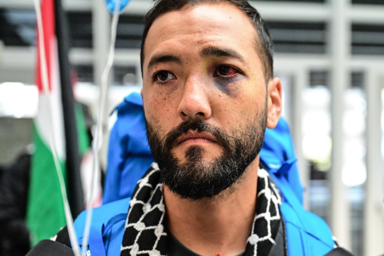 A black eye can be seen on Suza's face