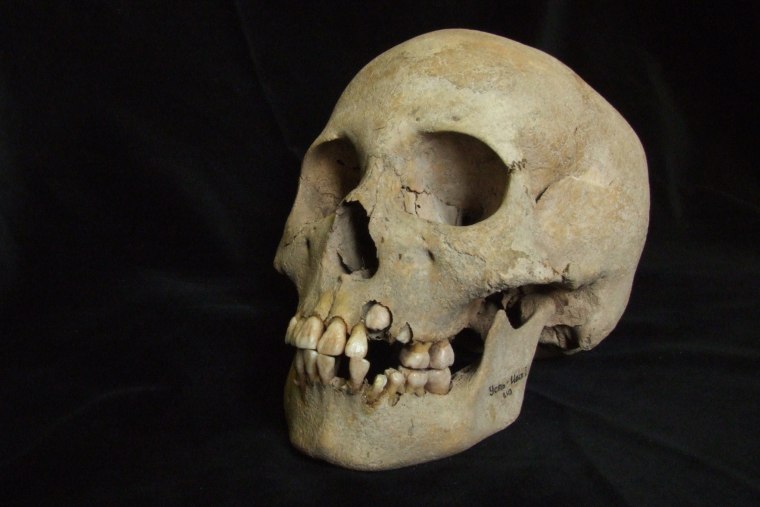 Skull of a girl aged between 9 and 11 years who was buried alongside plague victims at the Ustida I cemetery.