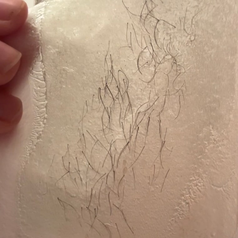 A closer look of the hair removal from the wax strips.