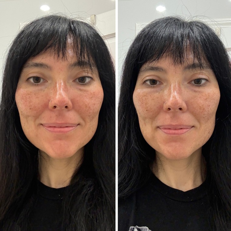 Tester Melissa Matthews before (left) and after (right) applying the Dr. Idriss Left Un-Red CalmBack Cream