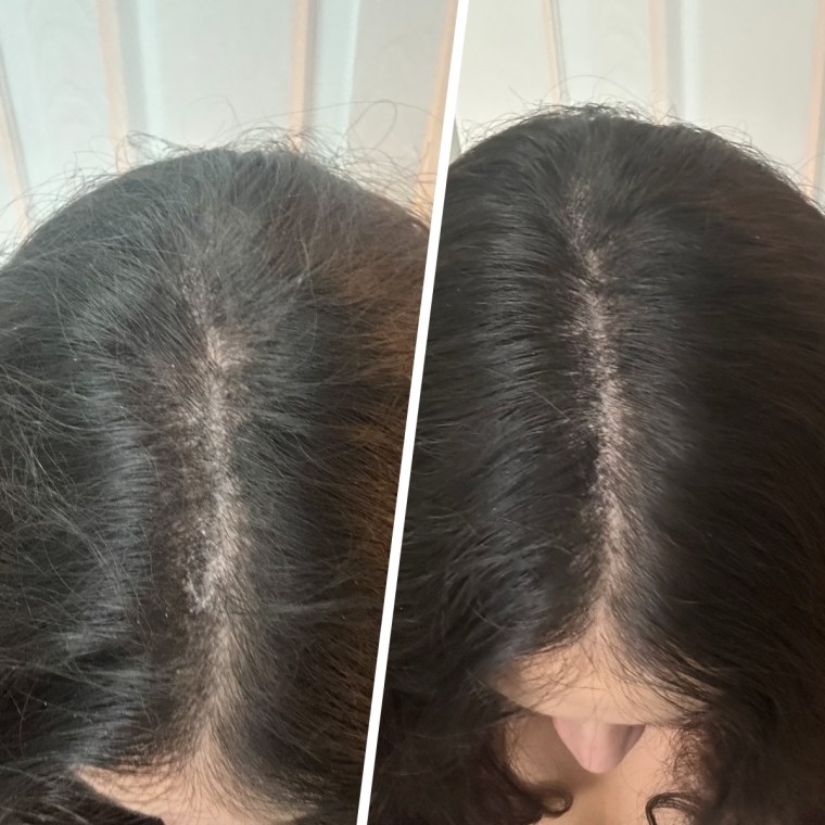 Before (left) and after (right)