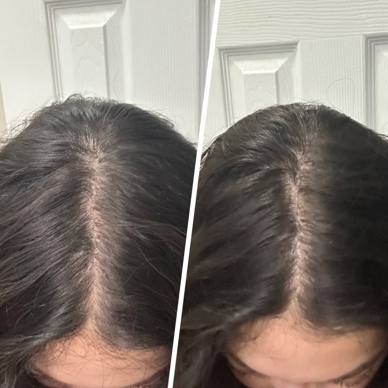 Before (left) and after (right)