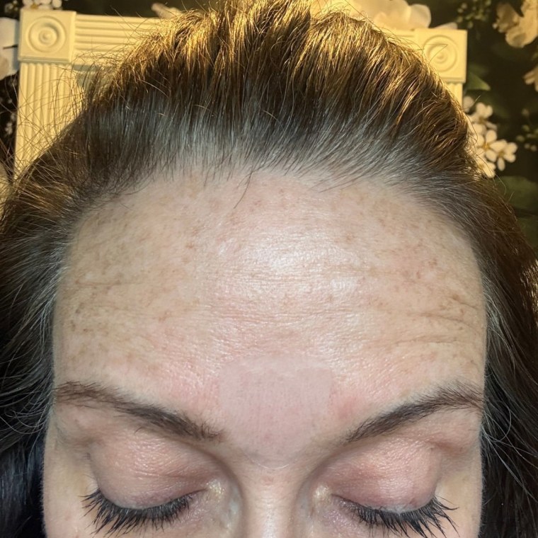 The Blumbody patch positioned between my brows is so transparent, you can barely see it.
