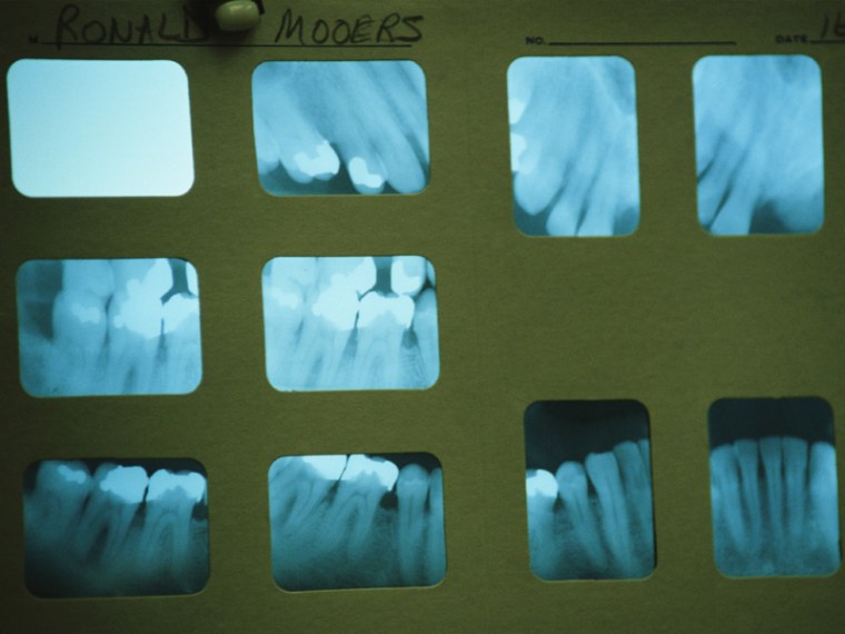 Ask your dentist to use X-rays as little as possible.