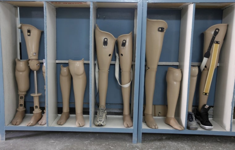 Prosthetic legs are displayed at the Orthopedic Center of the International Committee of the Red Cross in Kabul.