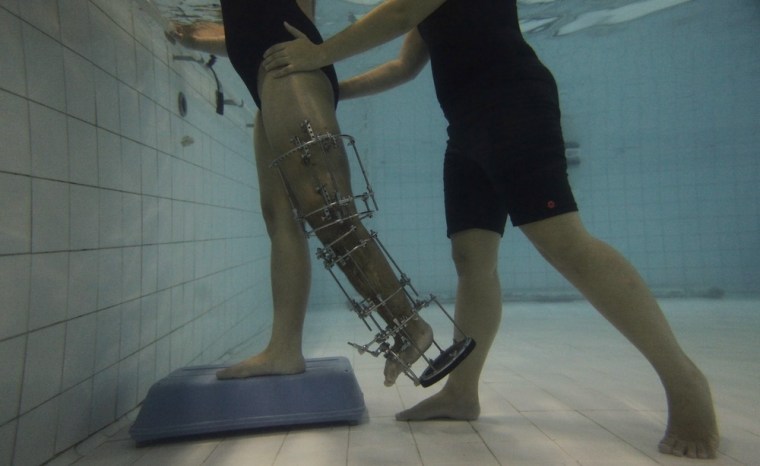 A girl wearing a brace on her leg is assisted by a physical therapist during a hydrotherapy session at the AACD on April 3.