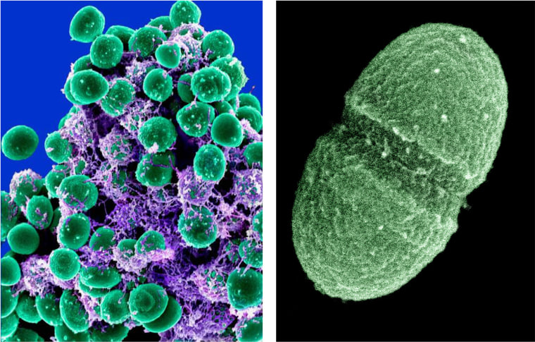 A clump of Staphylococcus epidermidis bacteria (green) in the extracellular matrix, which connects cells and tissue, taken with a scanning electron microscope. At right, the bacterium Enterococcus faecalis, which lives in the human gut, is just one type of microbe that live on your skin, up your nose, in your gut; enough bacteria, fungi and other microbes that collected together could weigh a few pounds. (AP Photo/National Institute of Allergy and Infectious Diseases (NIAID, Agriculture Department)
