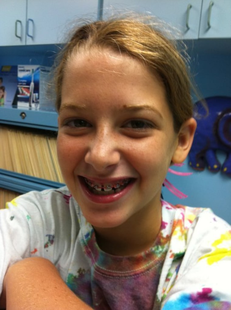 Katie showing off the braces she got two days ago!