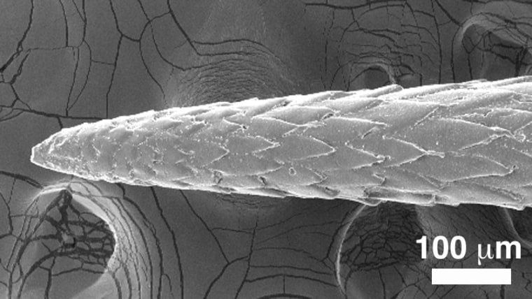 Porcupine Quills Inspire Better Needles For Medical Devices