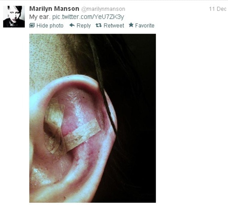 Marilyn Manson tweeted a photo of his injured ear Friday.