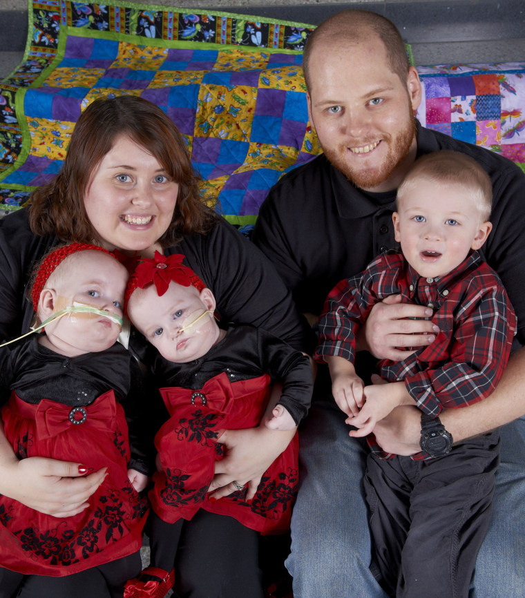 Separated twins Allison and Amelia with dad Greg, big brother Owen, and their mom Shellie, who has kept a blog about her twins' progress.