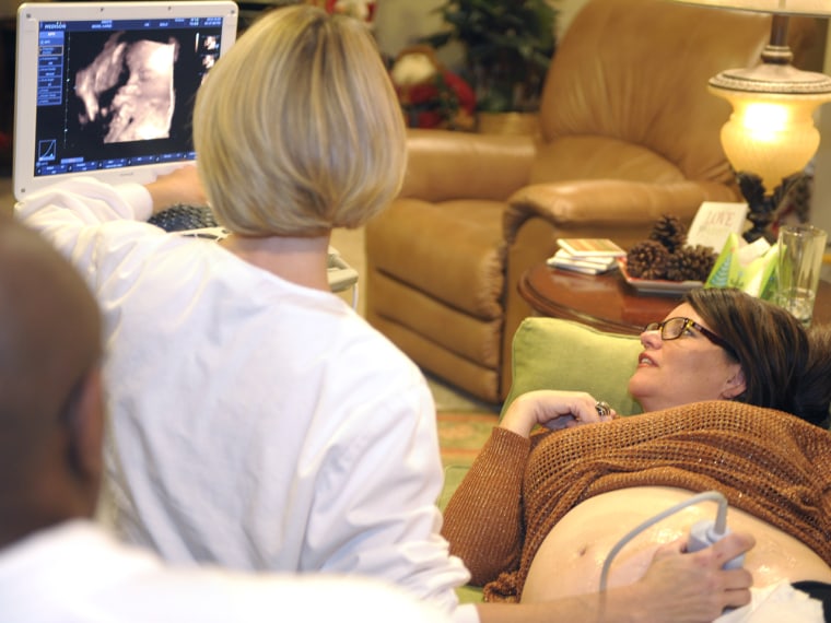 two pregnant women looking ultrasound photo album in living room Stock  Photo